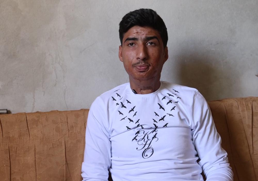 Abdulbari est un patient syrien de MSF âgé de 19 ans. Il a été victime d'un tir de missile en 2015 et gravement brûlé. Il a été admis à l'hôpital MSF d'Atmeh, dans le nord-ouest de la Syrie, et a reçu des soins depuis lors. Il nous parle du tremblement de terre et des besoins d'aide humanitaire dans sa région. Il vit à trente kilomètres au sud-ouest d'Idleb, à Jisr al-Shughour. © OMAR HAJ KADOUR 