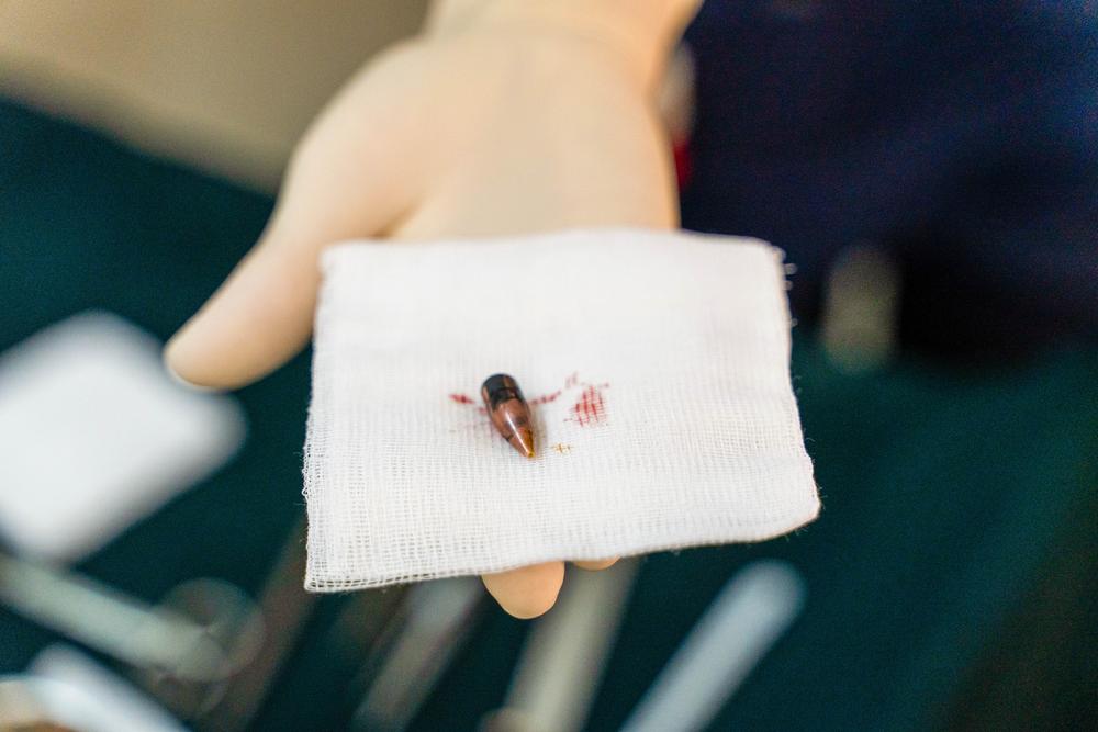 A bullet extracted from a patient. Gunshot wounds are one of the most common cases treated daily at Bashair Hospital. May 2023 