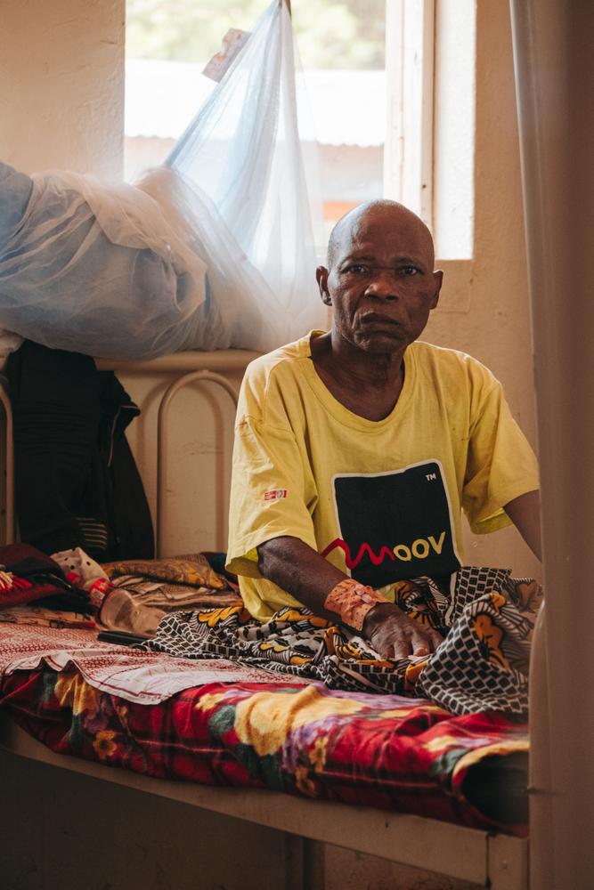 Dieudonné Nengbi, 59, is treated at the Bangassou Regional Hospital. He suffered a motorbike accident and was brought here two months ago, Bangassou. 